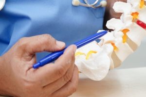 What Is A Herniated Disc San Antonio TX