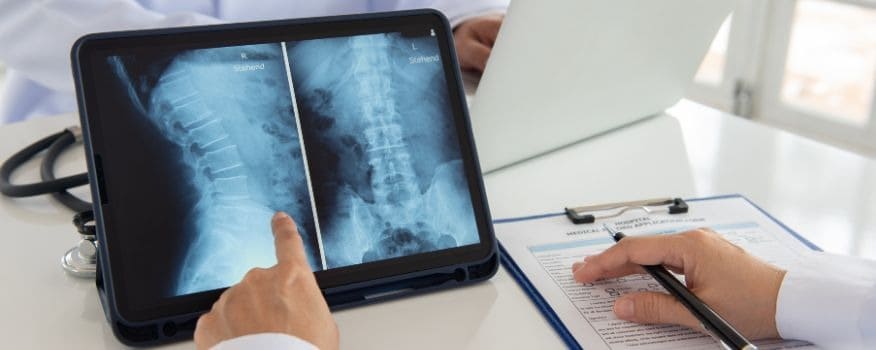 Digital X-Ray San Antonio