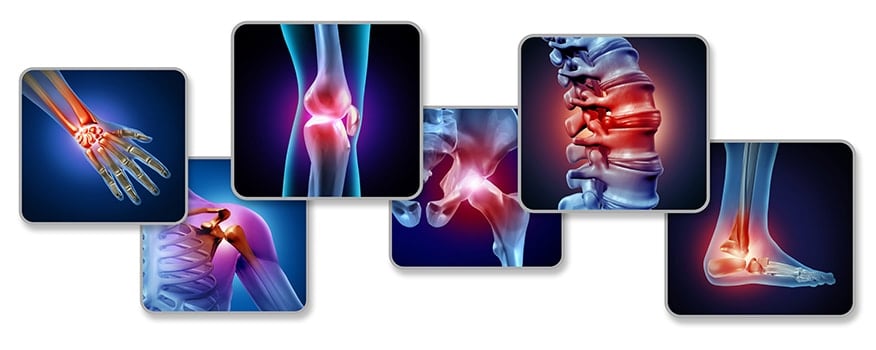 Joint Pain San Antonio