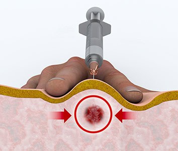 Trigger Points San Antonio